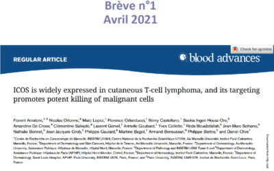 ICOS est fortement exprimé dans les lymphomes T cutanés épidermotropes et son ciblage permet l’inhibition des cellules tumorales